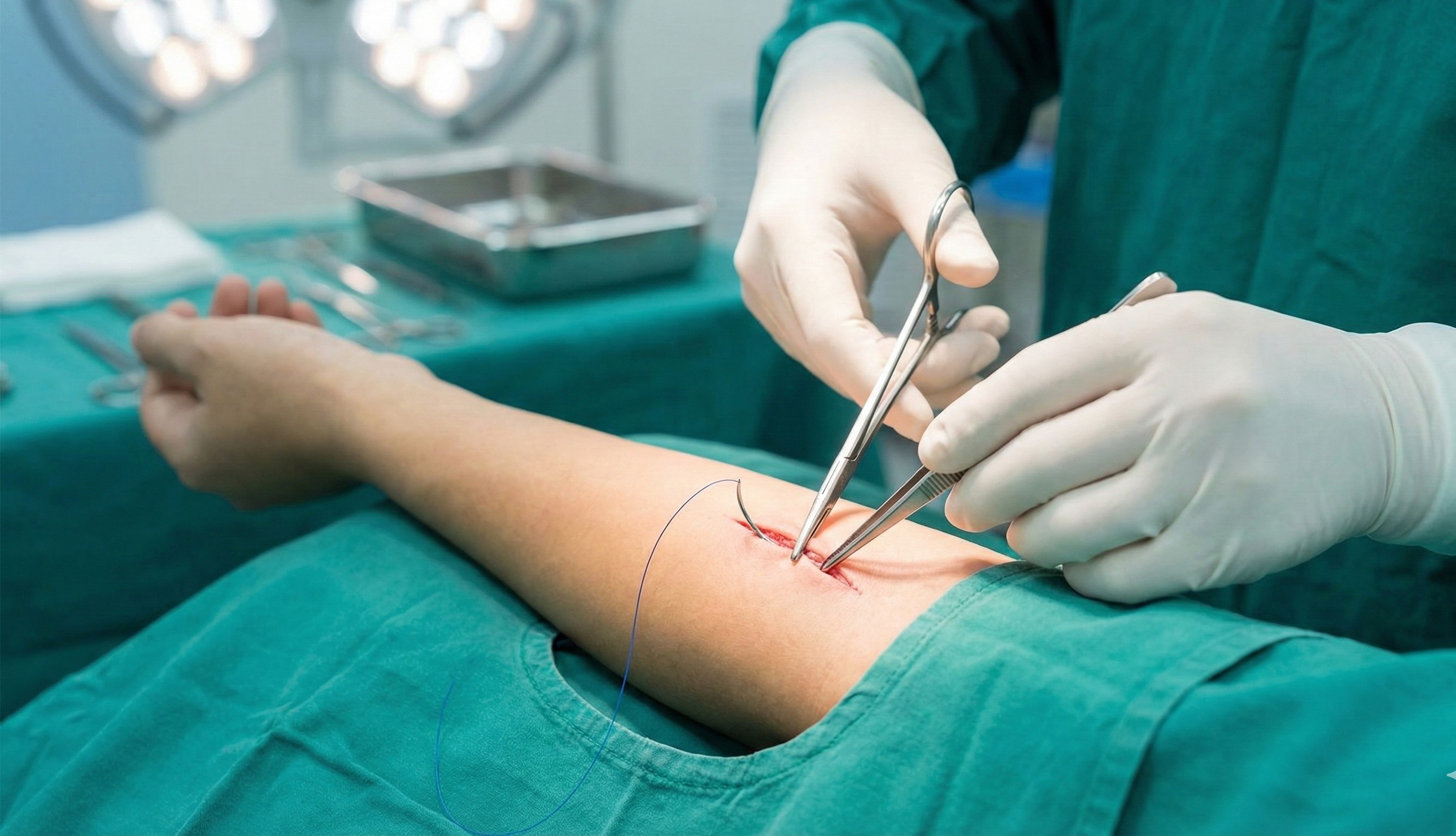 Suturing Service