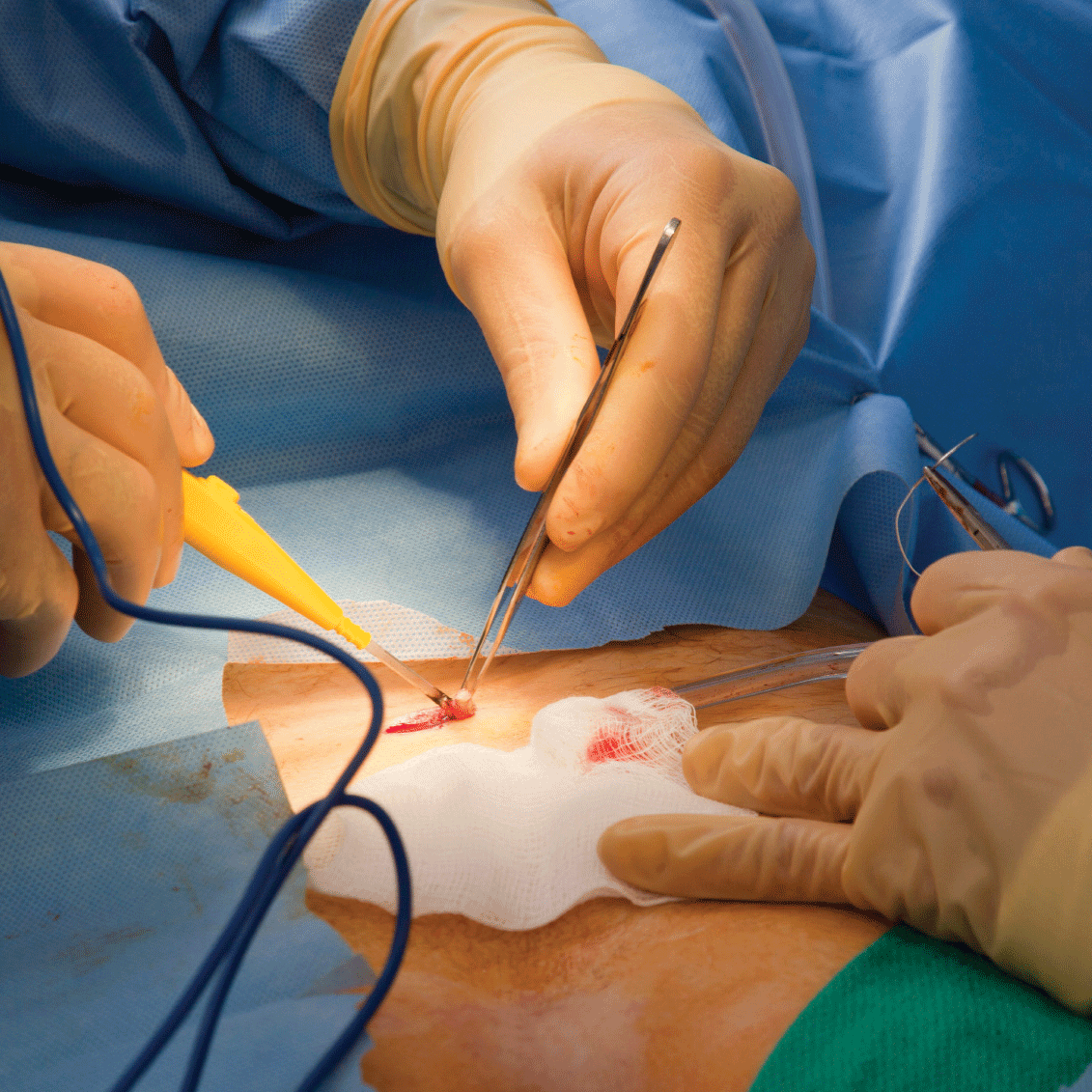 Suturing Service